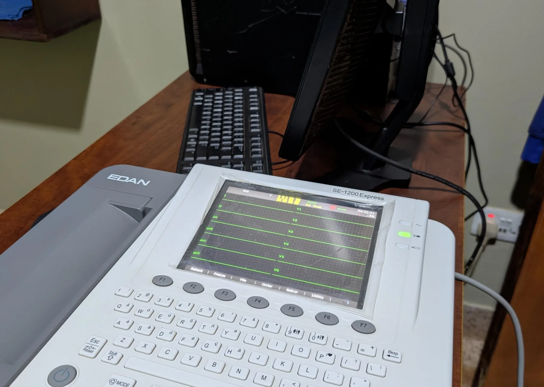 ECG & Cardiac Monitoring Unit