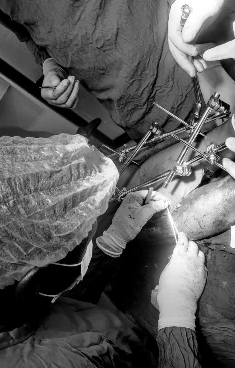 Orthopaedic Services at Bujuuko Hospital