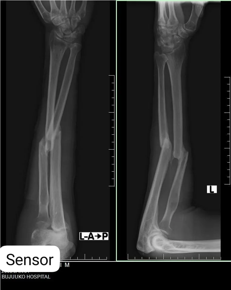 Digital X-ray imaging at Bujuuko Hospital.